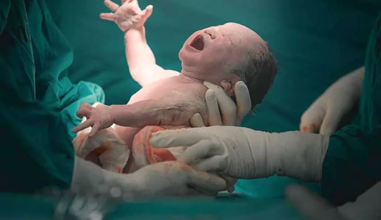 bébé né par césarienne