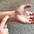 7 points d'acupression pour un bel accouchement