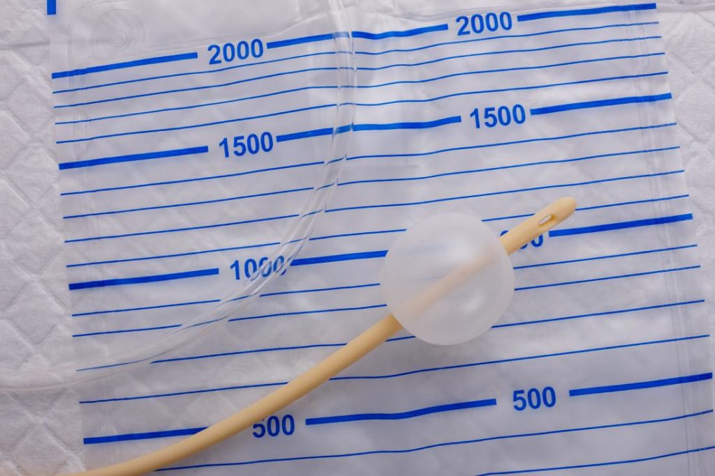 Tout ce que vous devez savoir sur le déclenchement par ballonnet
