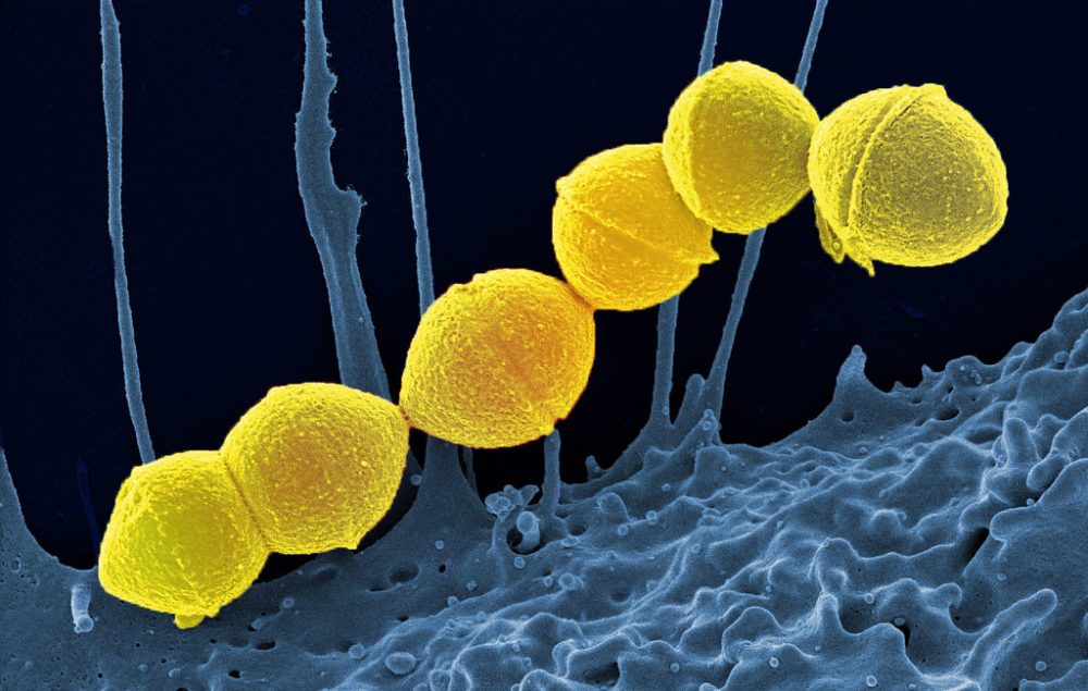 Le docteur Madeleine Matura, gynécologue-obstétricienne, vous conseille les meilleurs remèdes naturels pour soigner un streptocoque B pendant la grossesse sur Naturelle Maman