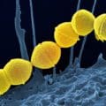 Le docteur Madeleine Matura, gynécologue-obstétricienne, vous conseille les meilleurs remèdes naturels pour soigner un streptocoque B pendant la grossesse sur Naturelle Maman