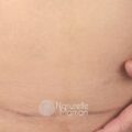 Consultation avec une sage-femme pour planifier une grossesse en toute sécurité après une césarienne - Naturelle Maman